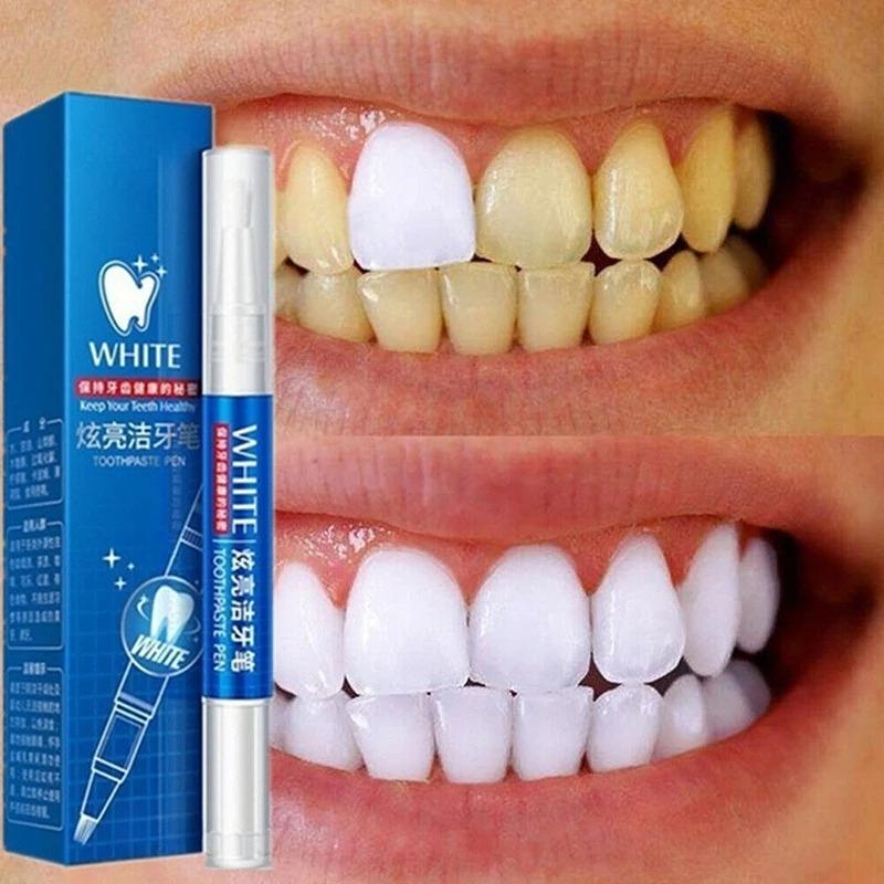 50 ML Teeth Whitening Stain Re - Teeth Whitening Gel Pen 评论和价格