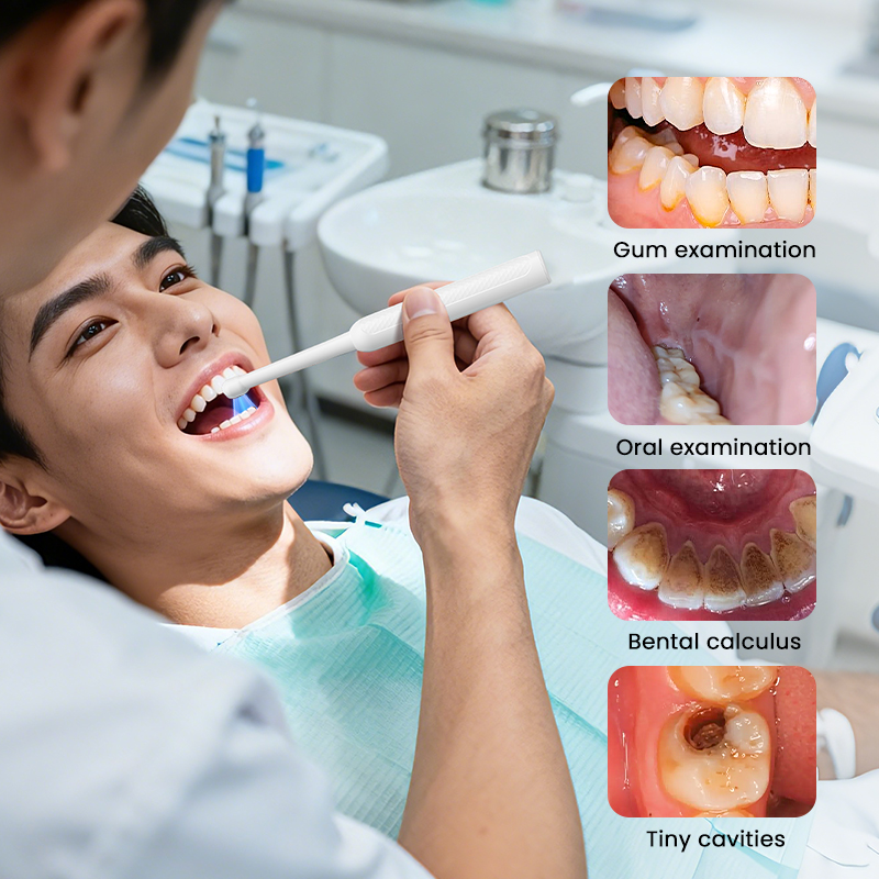 WIFI Oral Endoscope Handheld W - Teeth Whitening Video 评论和价格