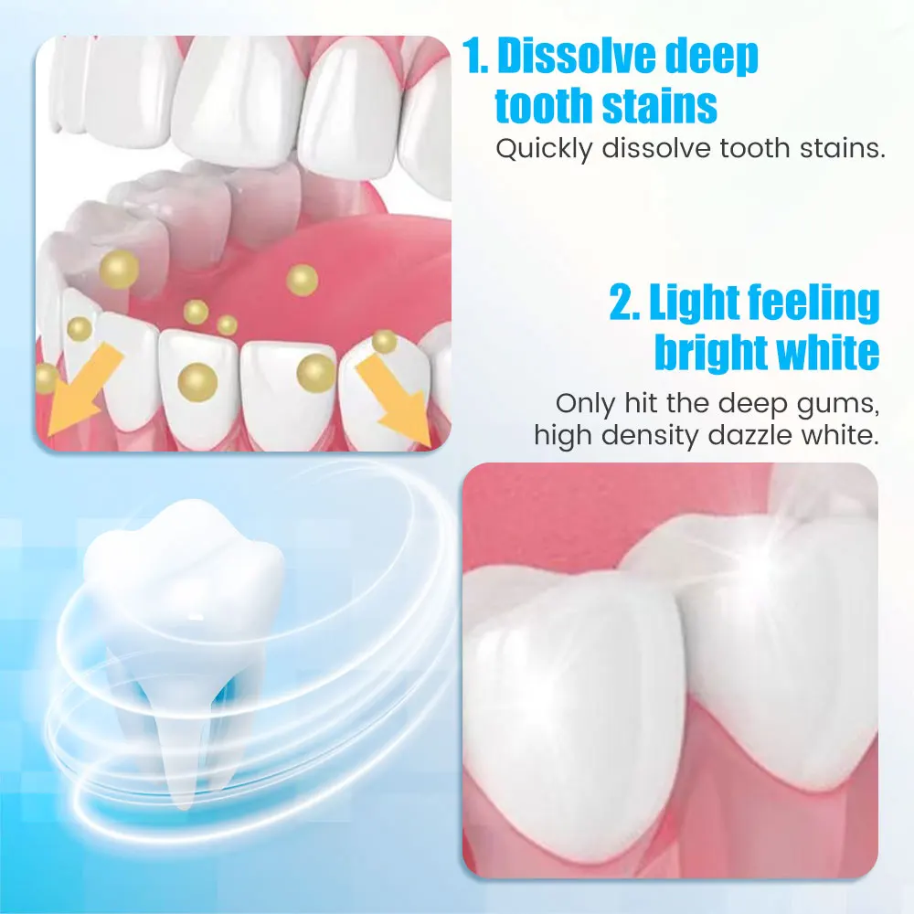 9D Teeth Whitening Stickers Mi - Teeth Whitening Yellow Teeth 评论和价格