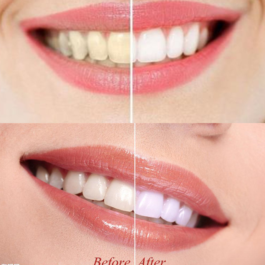 Bamboo Charcoal Teeth Tooth De - Teeth Whitening Yellow Teeth 评论和价格