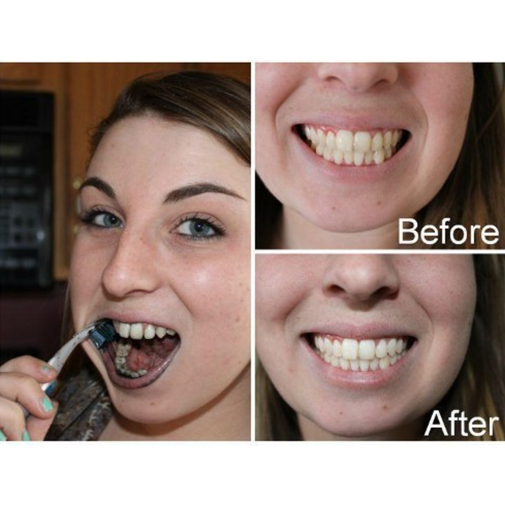 Bamboo Charcoal Teeth Tooth De - Teeth Whitening Yellow Teeth 评论和价格