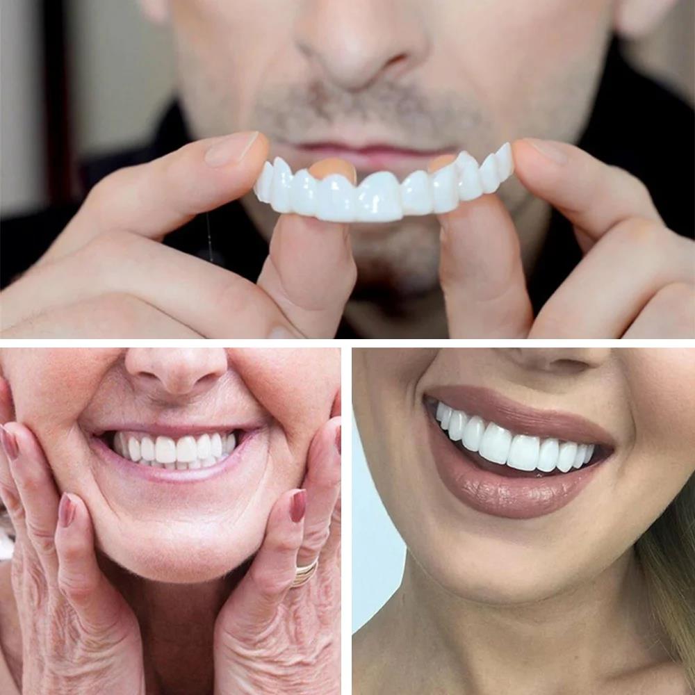 New KOL Influencer Teeth Venee - Teeth Whitening Video 评论和价格