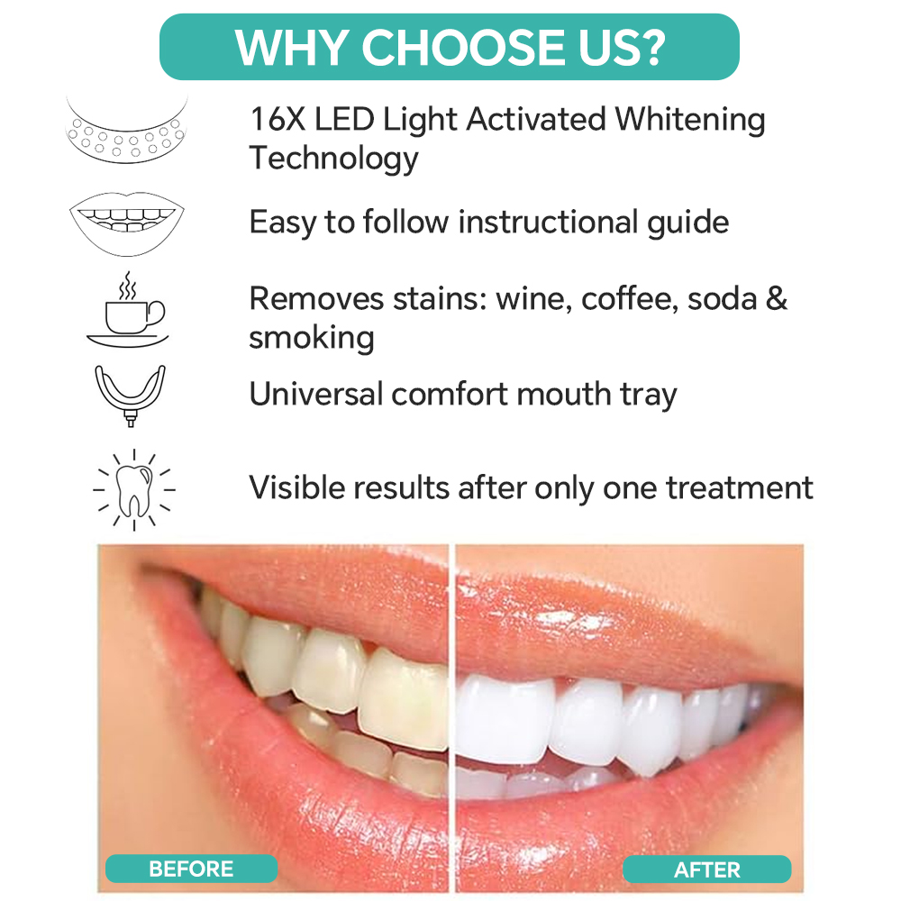 Teeth Whitening Accelerator Li - Teeth Whitening Accelerator 评论和价格