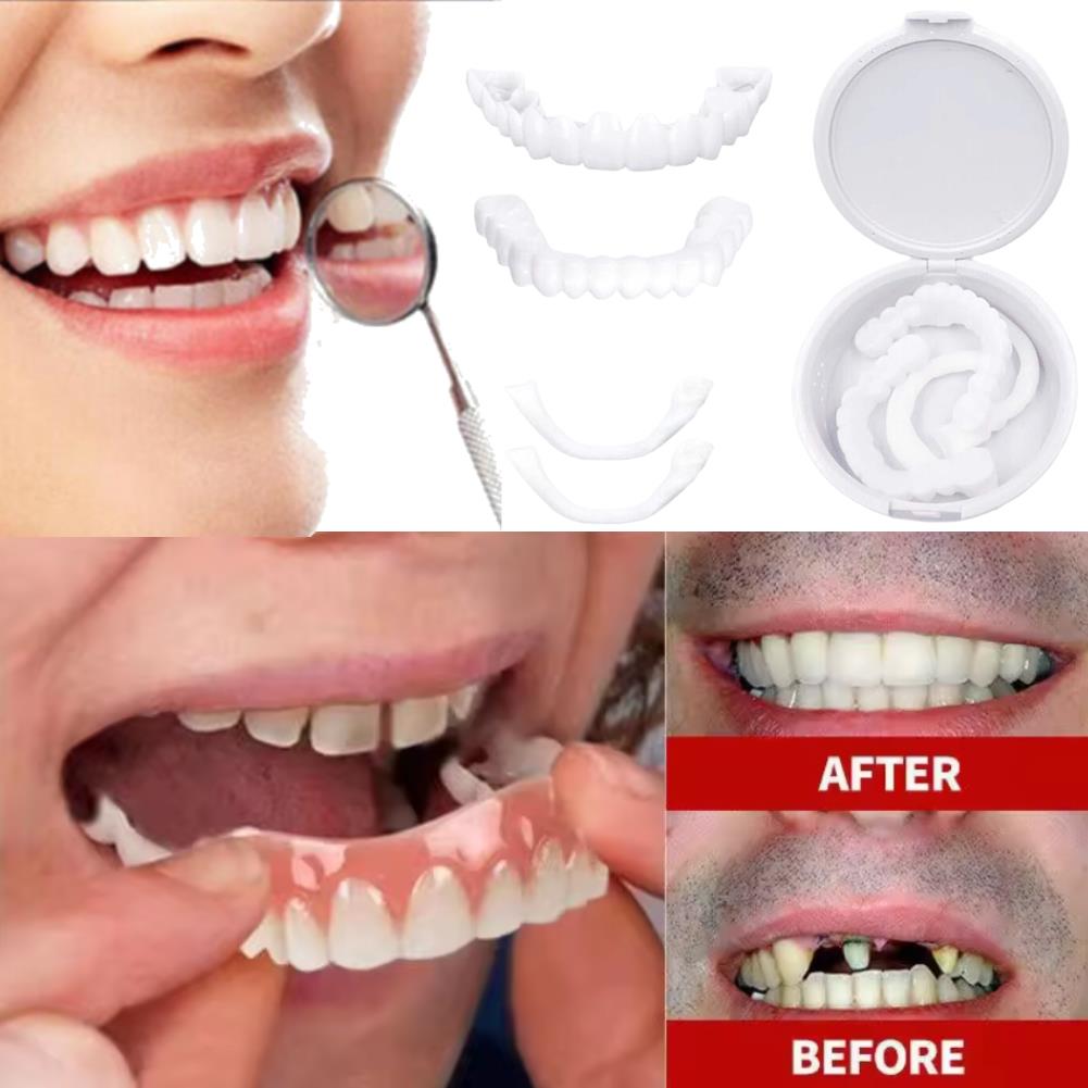 New KOL Influencer Teeth Venee - Teeth Whitening Video 评论和价格