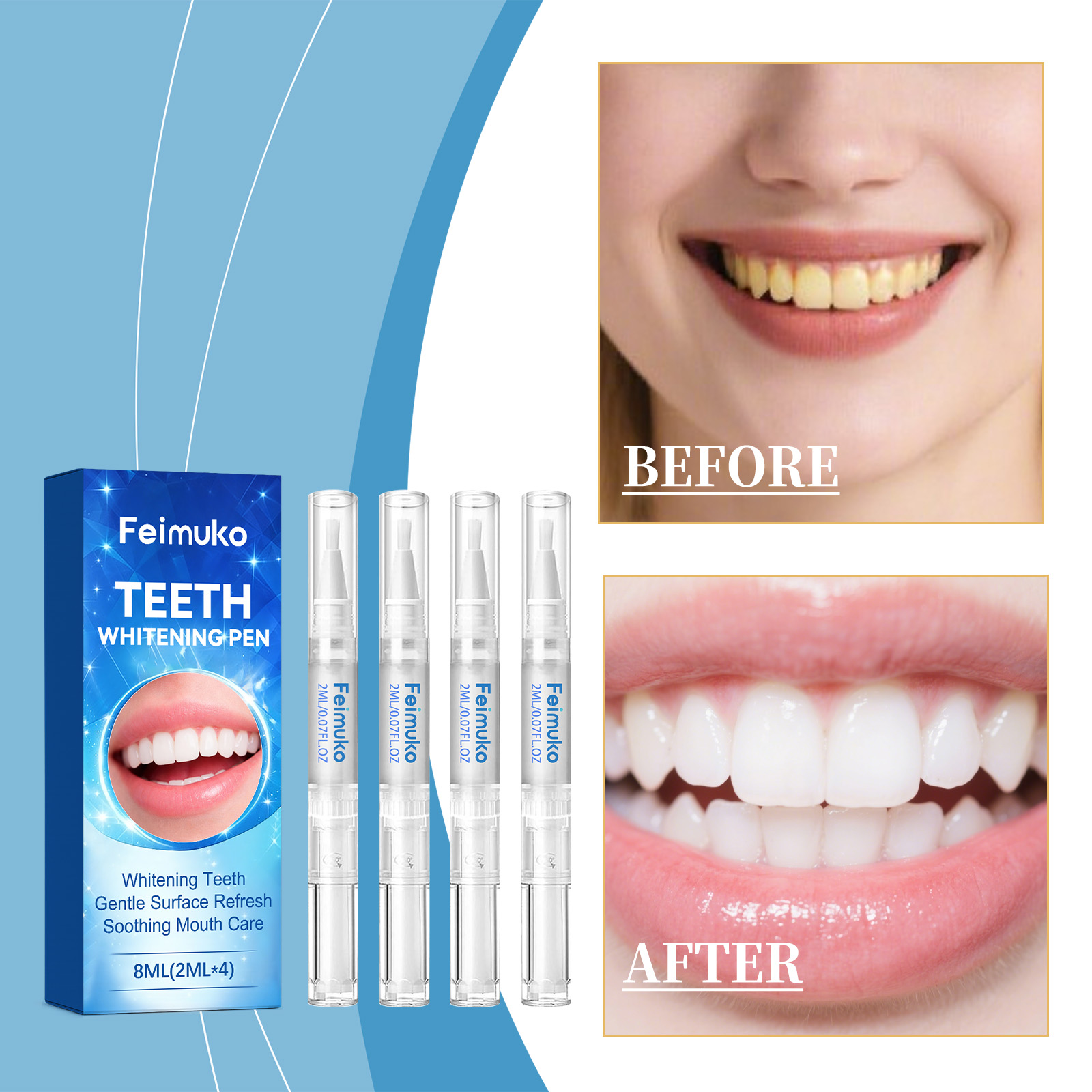 Feimuko 8ml Teeth Gel Pen Gent - Teeth Whitening Gel Pen 评论和价格
