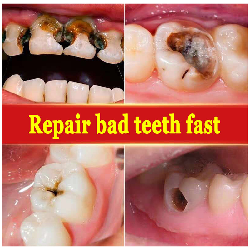 120g Probiotic Whitening Tooth - Teeth Whitening With Coconut Oil 评论和价格