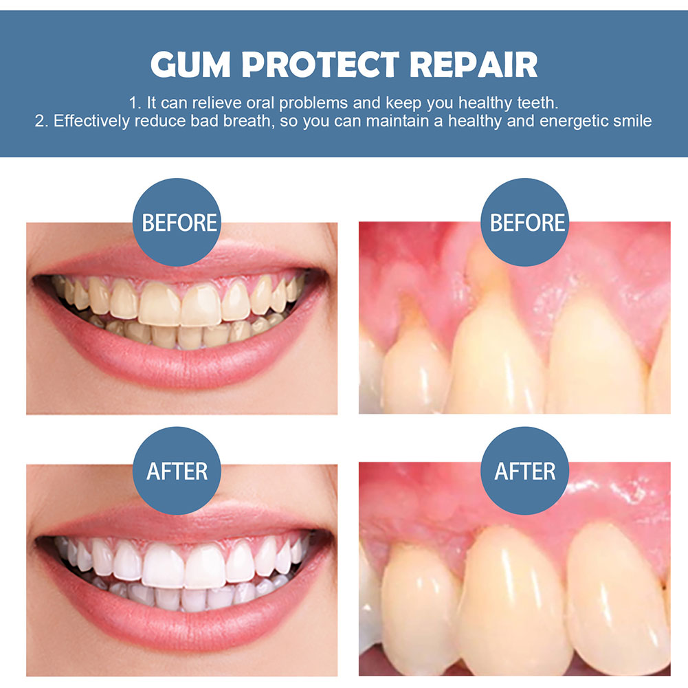Gum Protection Repair Gel Reli - Teeth Whitening Gel Pen 评论和价格