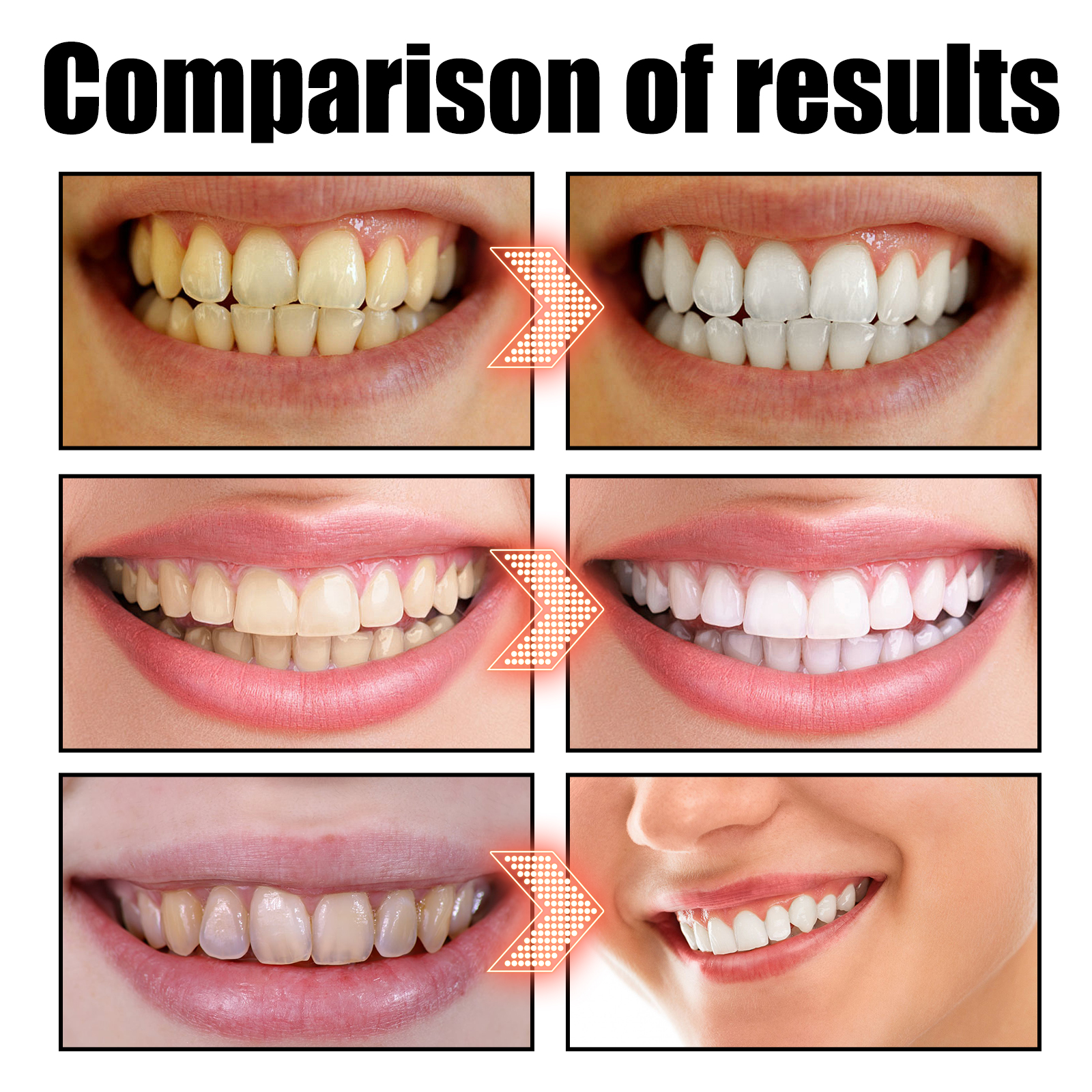 Coconut Oil Mouthwash Whitenin - Teeth Whitening With Coconut Oil 评论和价格
