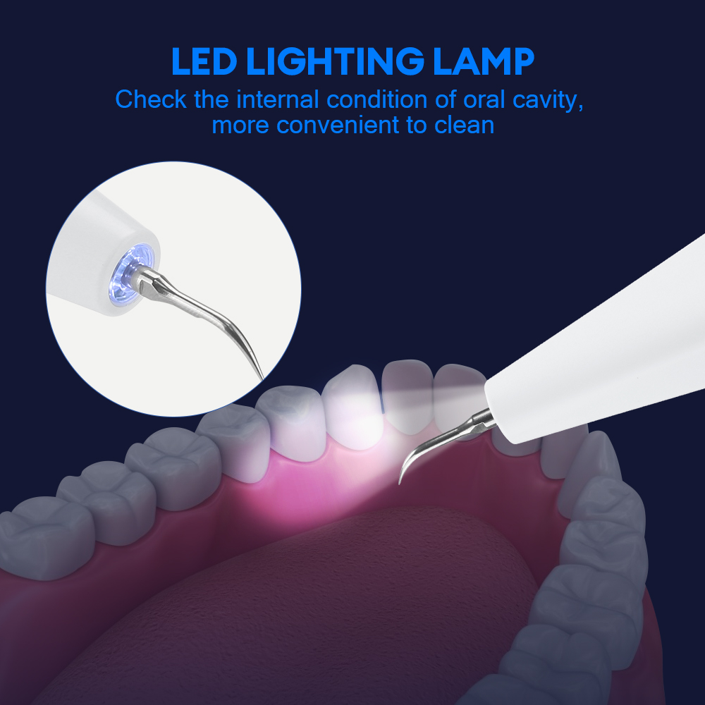 Ultrasonic Dental Calculus Rem - Teeth Whitening Professional 评论和价格