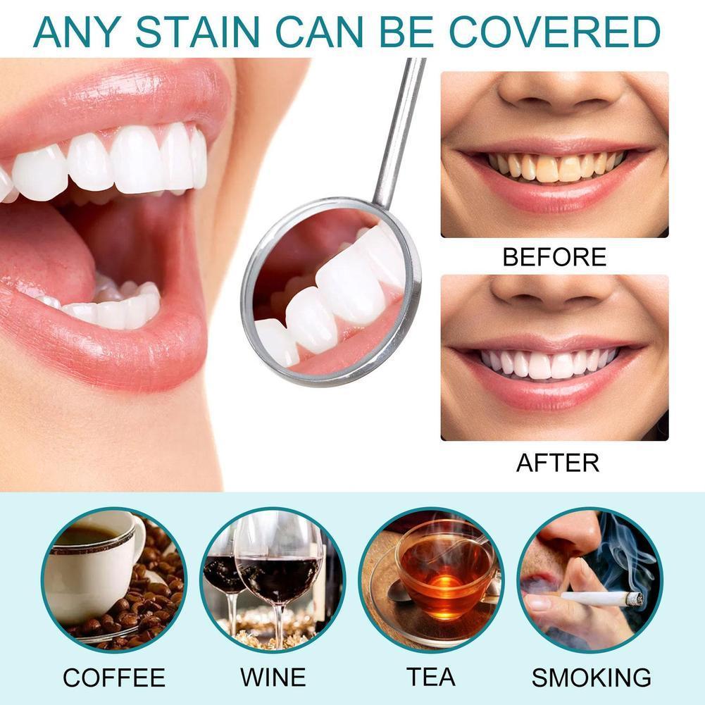 Teeth White Paint Anti Pigment - Teeth Whitening Gel Pen 评论和价格