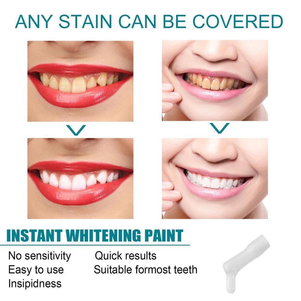 Teeth White Paint Anti Pigment - Teeth Whitening Gel Pen 评论和价格