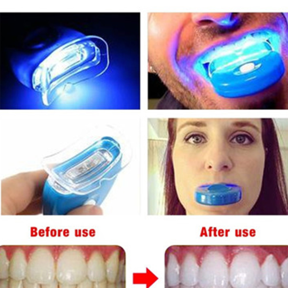 New Blue Led Teeth Whitening A - Teeth Whitening Video 评论和价格
