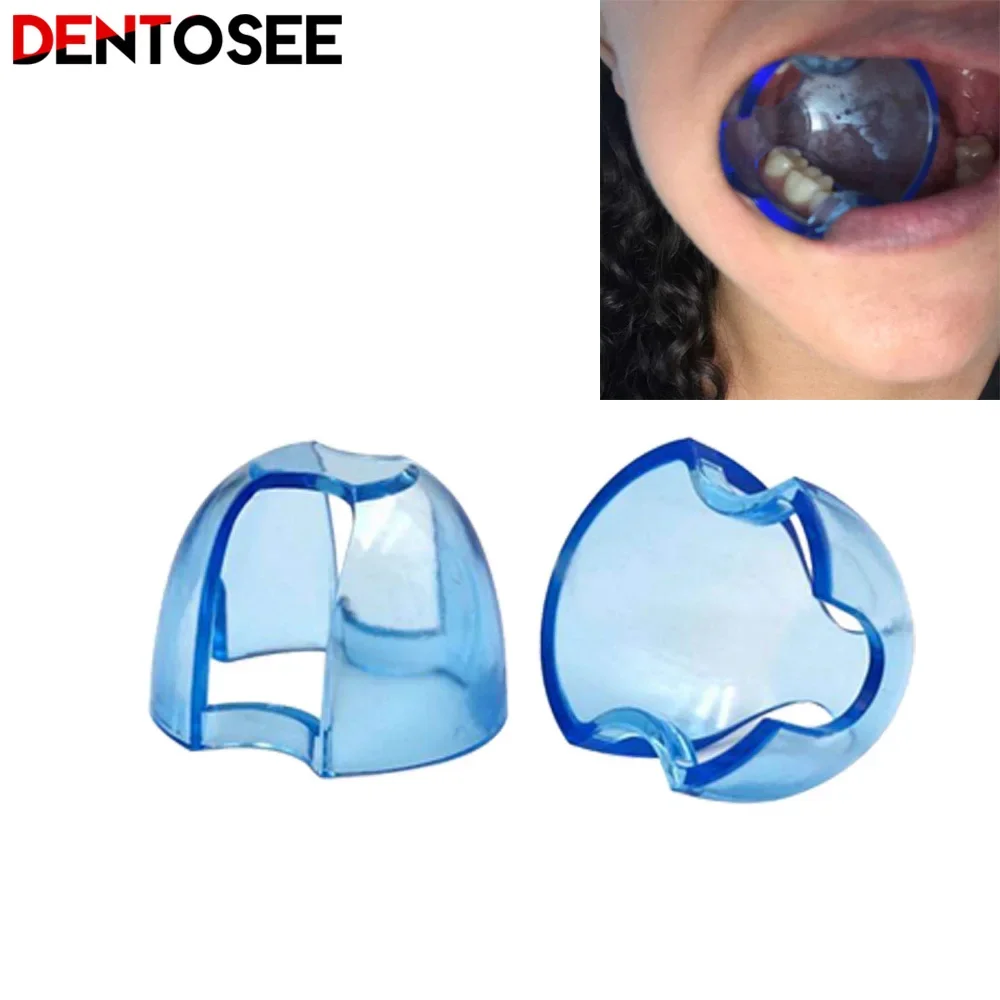 Dental Intraoral Cheek Retract - Teeth Whitening Accelerator 评论和价格