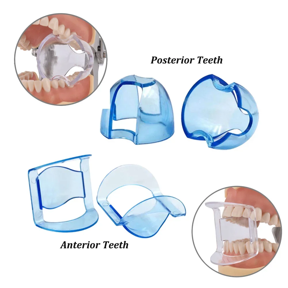 Dental Intraoral Cheek Retract - Teeth Whitening Accelerator 评论和价格