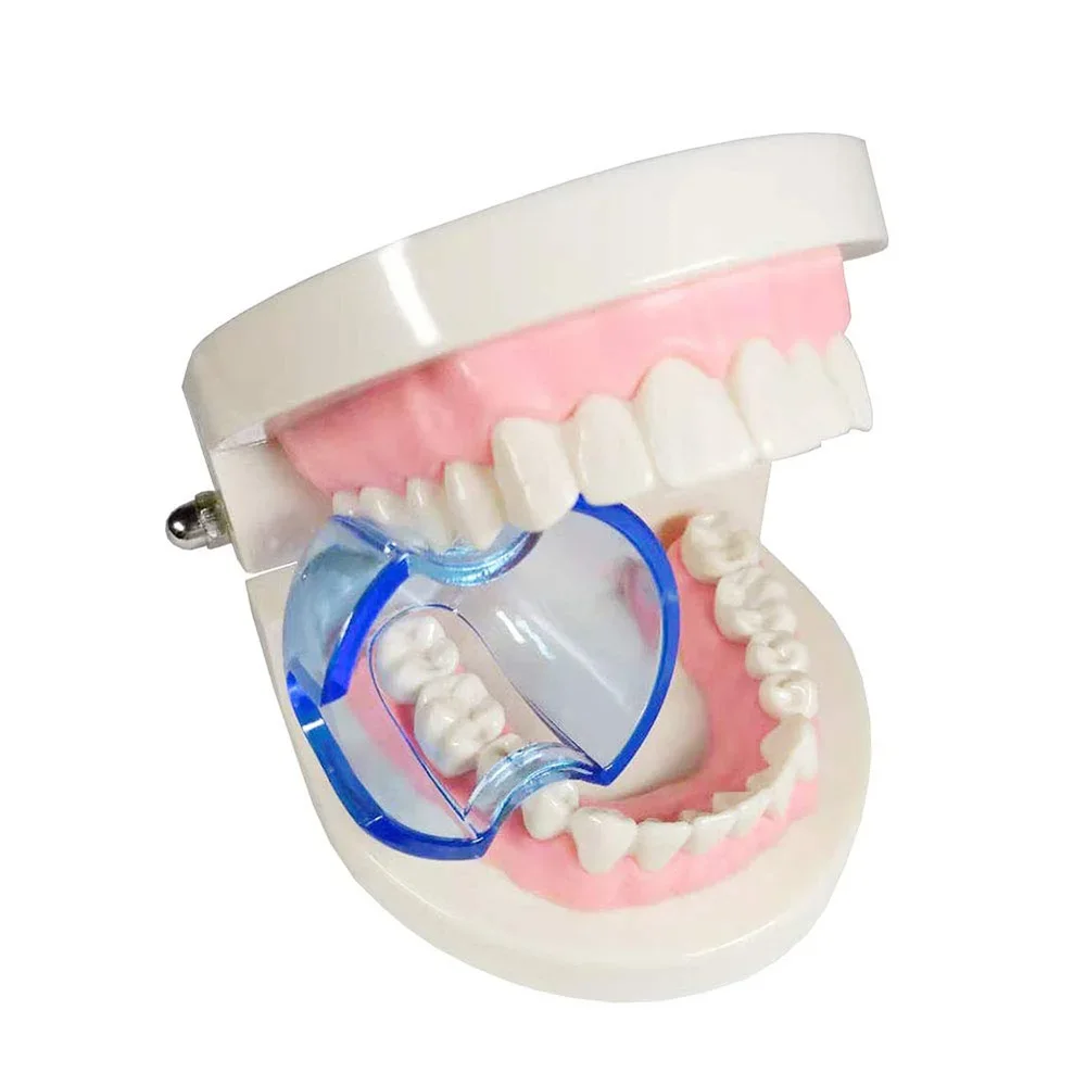 Dental Intraoral Cheek Retract - Teeth Whitening Accelerator 评论和价格