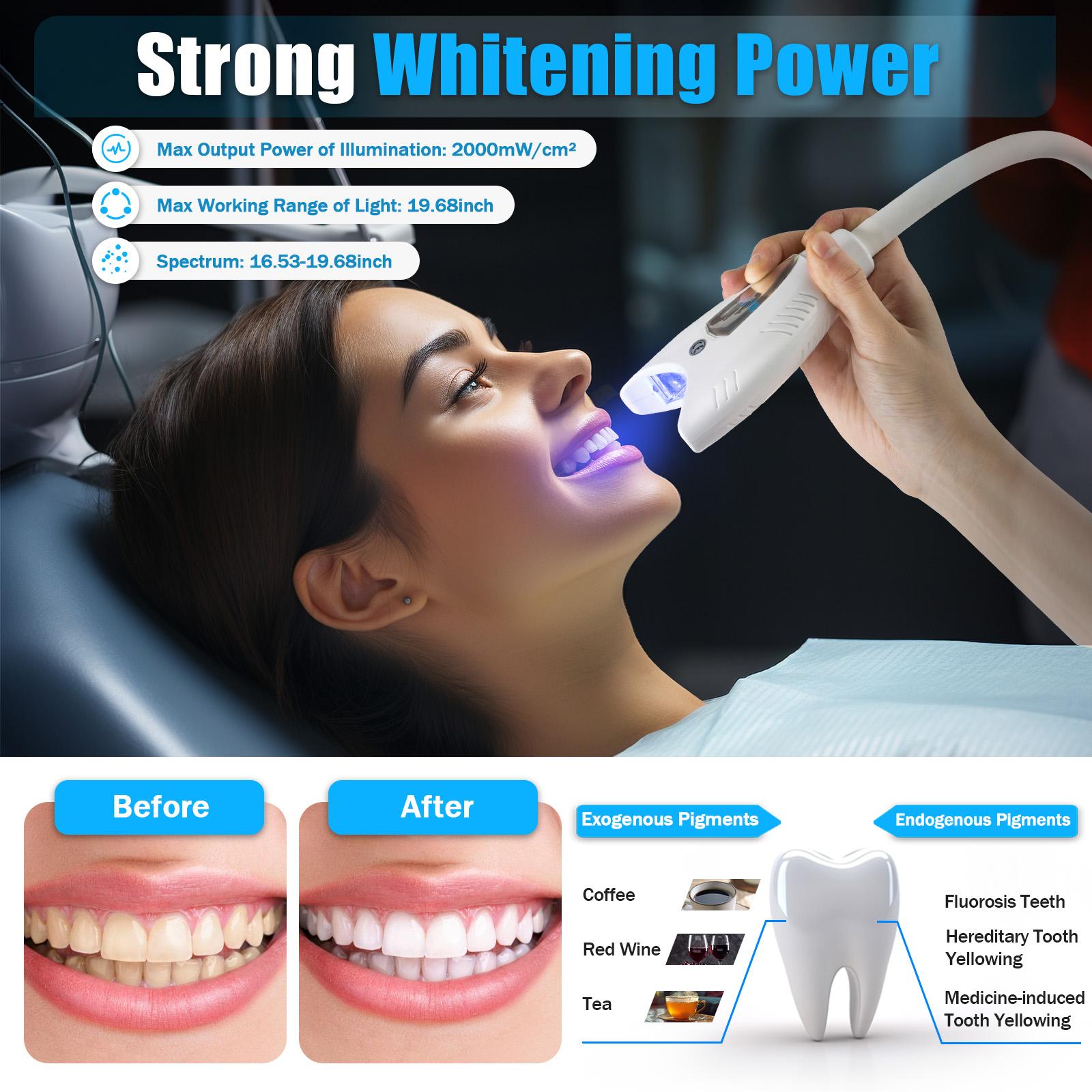 Mobile Dental Teeth Whitening  - Teeth Whitening Video 评论和价格