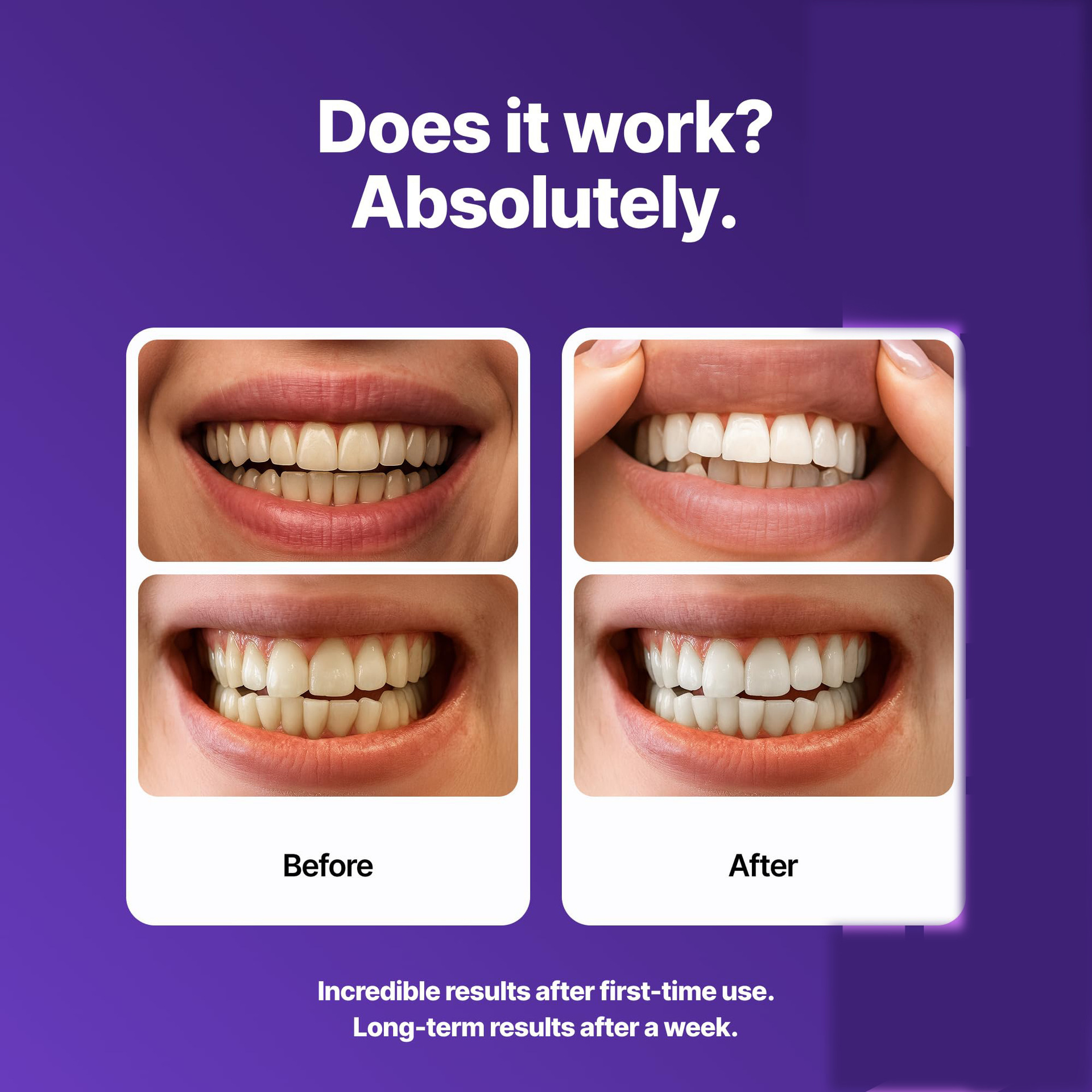 Purple Brightening Dental Patc - Teeth Whitening Yellow Teeth 评论和价格